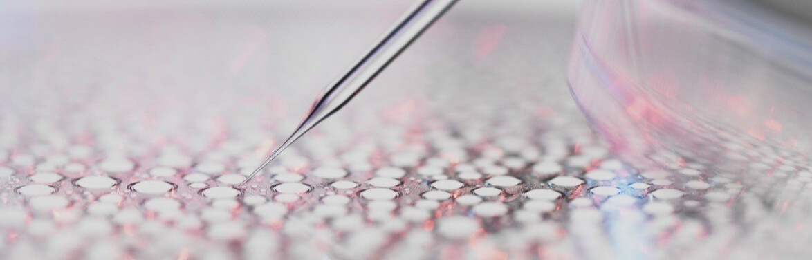 Découvrez notre approche scientifique unique, l'écobiologie.